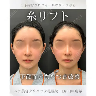 ルラ美容クリニック 札幌本院 田中 瑞希医師の症例