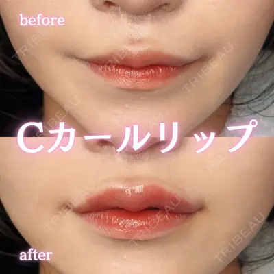ルラ美容クリニック 新宿院 陶 美梨医師の症例