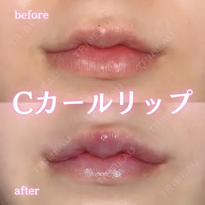 ルラ美容クリニック 新宿院 陶 美梨医師の症例