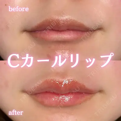 ルラ美容クリニック 新宿院 陶 美梨医師の症例