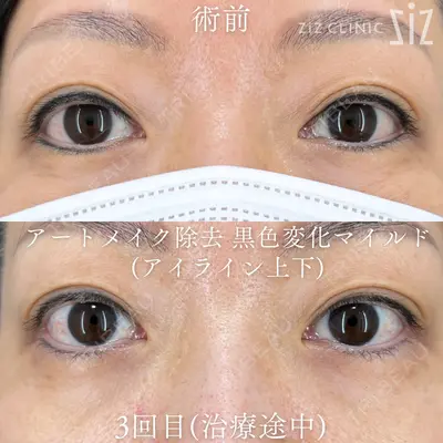 ziz CLINIC 村岡 史子医師の症例