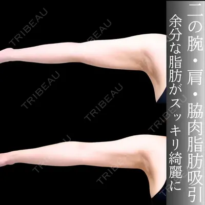 アリエル美容クリニック 横浜院 加藤 敏次医師の症例