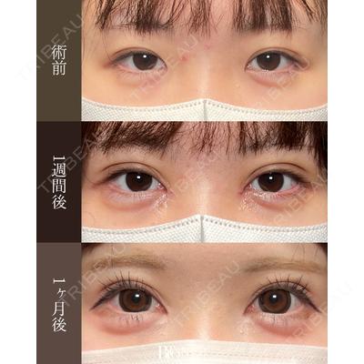 BITO BEAUTY CLINIC 伊藤 富良野医師の症例