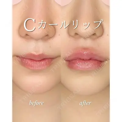 ルラ美容クリニック 札幌大通り院 能登 貴弘医師の症例