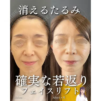 ルラ美容クリニック 渋谷本院 住友 沙織医師の症例