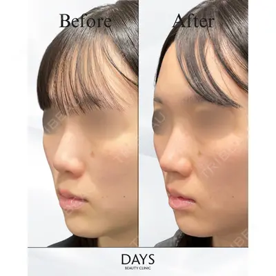 Days Beauty Clinic 新宿院の症例