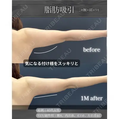 eクリニック 岡山院 勘定 正哉医師の症例
