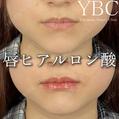 YBC横浜美容外科 立川院 大島 諒士医師の症例