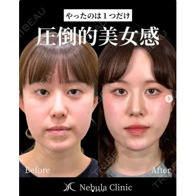 愛知春日井美容外科ネビュラクリニック 都築 諒医師の症例