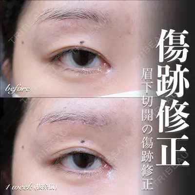 EMMO FACE CLINIC 大宮院 百瀬 直也医師の症例