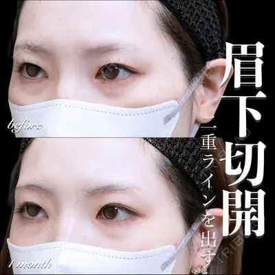 EMMO FACE CLINIC 大宮院 百瀬 直也医師の症例
