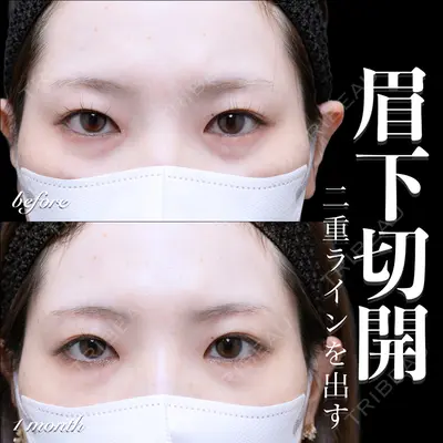 EMMO FACE CLINIC 大宮院 百瀬 直也医師の症例