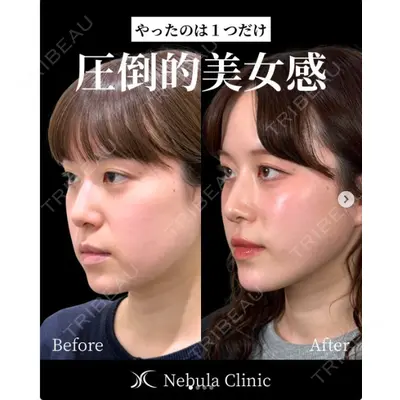 愛知春日井美容外科ネビュラクリニック 都築 諒医師の症例