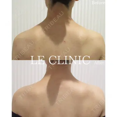 LE CLINICの症例