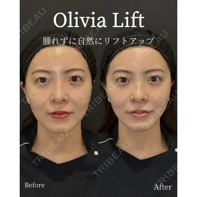 Olivia Clinic 中原 良介医師の症例