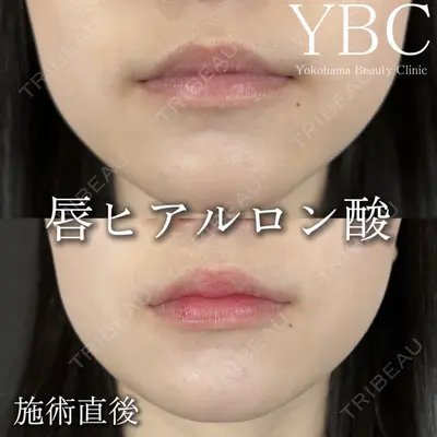 YBC横浜美容外科 立川院の症例