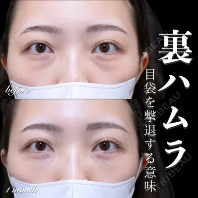 EMMO FACE CLINIC 大宮院 百瀬 直也医師の症例