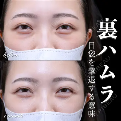 EMMO FACE CLINIC 大宮院 百瀬 直也医師の症例