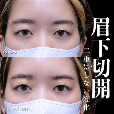EMMO FACE CLINIC 大宮院 百瀬 直也医師の症例