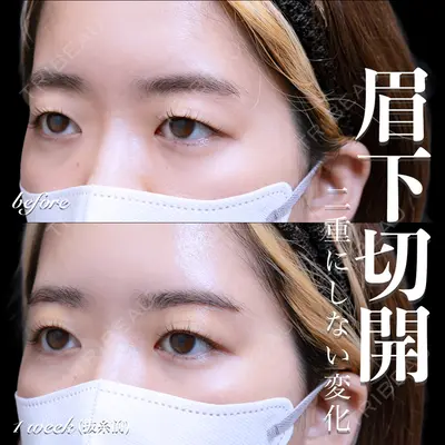 EMMO FACE CLINIC 大宮院 百瀬 直也医師の症例
