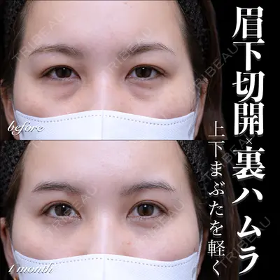 EMMO FACE CLINIC 大宮院 百瀬 直也医師の症例