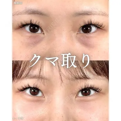 新宿美容外科ネビュラクリニック 山本 紘子医師の症例