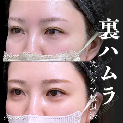 EMMO FACE CLINIC 大宮院 百瀬 直也医師の症例