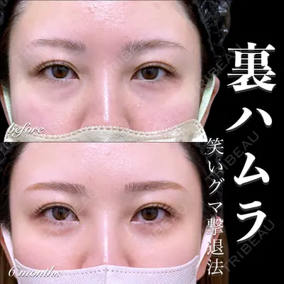 EMMO FACE CLINIC 大宮院 百瀬 直也医師の症例