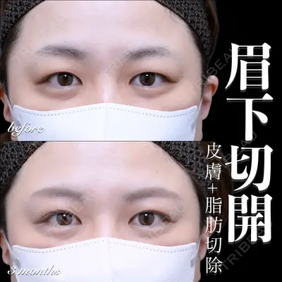 EMMO FACE CLINIC 大宮院 百瀬 直也医師の症例