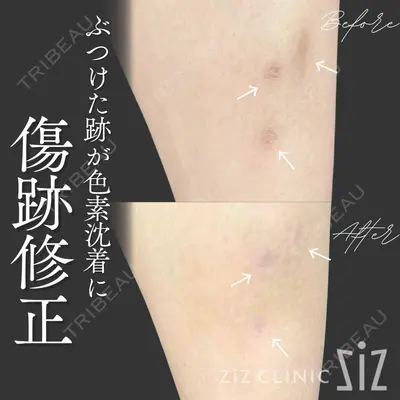 ziz CLINIC 村岡 史子医師の症例