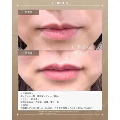 Clinic9の症例