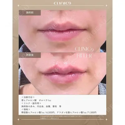 Clinic9の症例