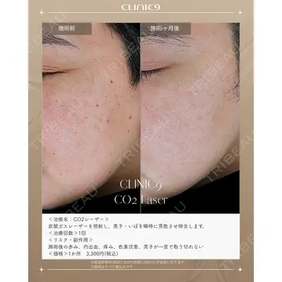 Clinic9の症例