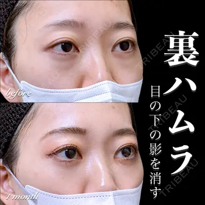 EMMO FACE CLINIC 大宮院 百瀬 直也医師の症例