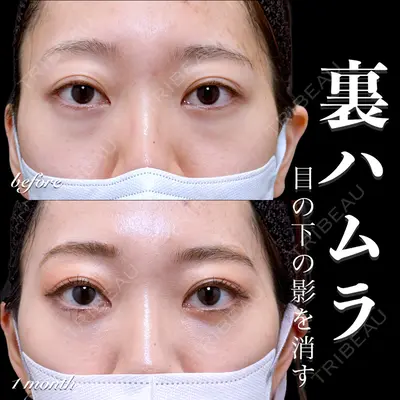 EMMO FACE CLINIC 大宮院 百瀬 直也医師の症例