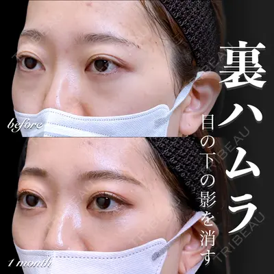 EMMO FACE CLINIC 大宮院 百瀬 直也医師の症例