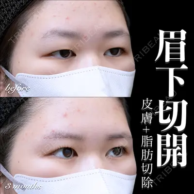 EMMO FACE CLINIC 大宮院 百瀬 直也医師の症例