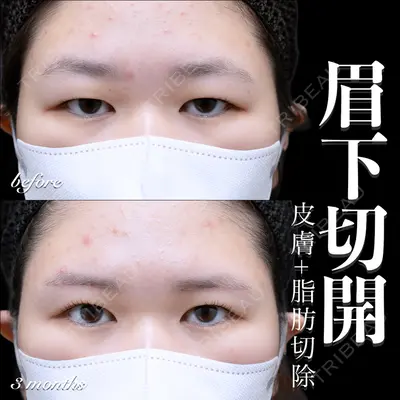 EMMO FACE CLINIC 大宮院 百瀬 直也医師の症例