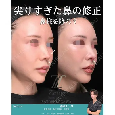 Zetith Beauty Clinic 銀座院 小川 悟史医師の症例