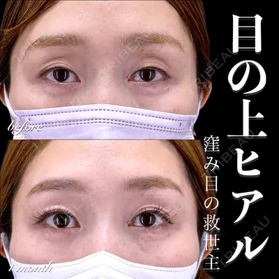 EMMO FACE CLINIC 大宮院 百瀬 直也医師の症例