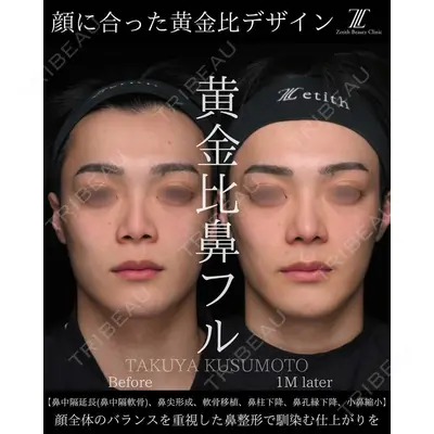 Zetith Beauty Clinic 大阪心斎橋院 楠本 拓哉医師の症例