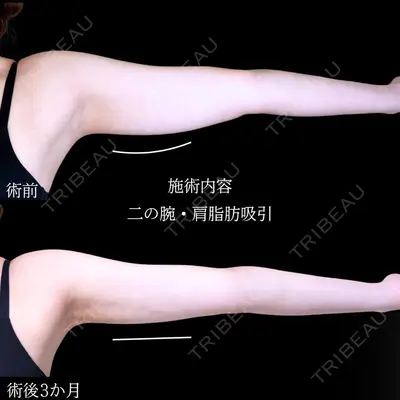 アリエル美容クリニック 横浜院 加藤 敏次医師の症例