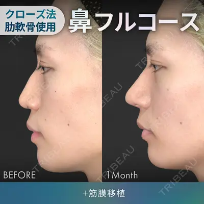 ジョウクリニック 銀座院 重本　譲医師の症例