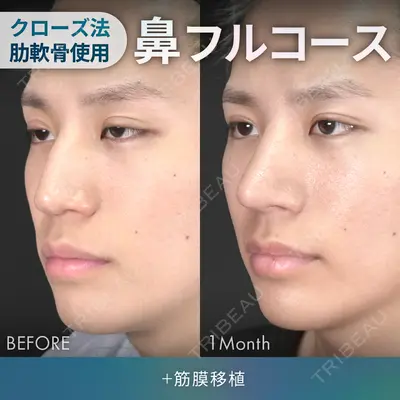 ジョウクリニック 銀座院 重本　譲医師の症例