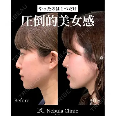 愛知春日井美容外科ネビュラクリニック 都築 諒医師の症例