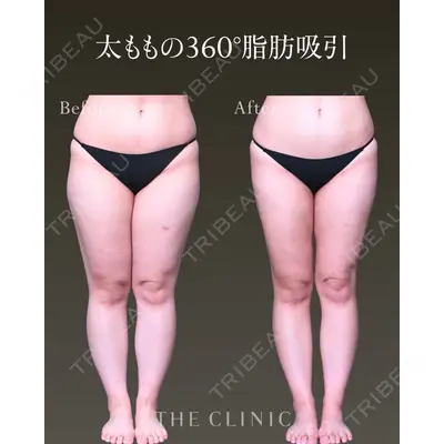 THE CLINIC（ザ・クリニック） 東京院 三塚 健太郎医師の症例