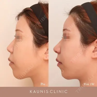 KAUNIS CLINIC（カウニスクリニック）の症例