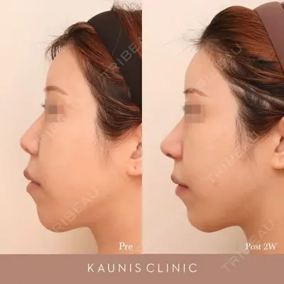 KAUNIS CLINIC（カウニスクリニック）の症例