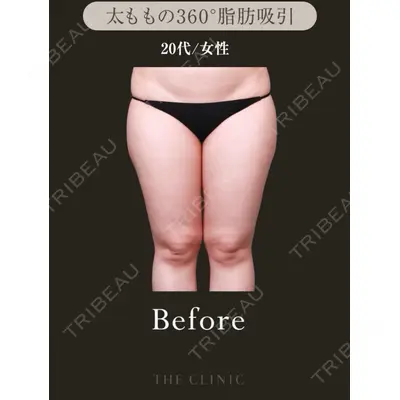 THE CLINIC（ザ・クリニック） 東京院 吉田 有希医師の症例