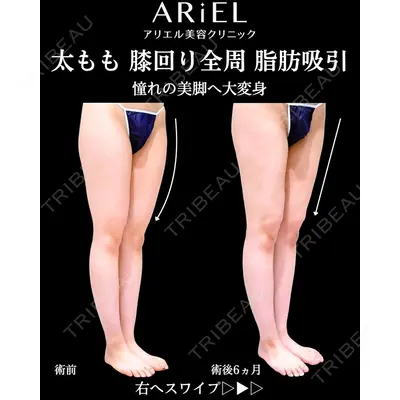 アリエル美容クリニック 横浜院 加藤 敏次医師の症例
